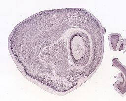 Gene Detail :: Allen Brain Atlas: Mouse Brain